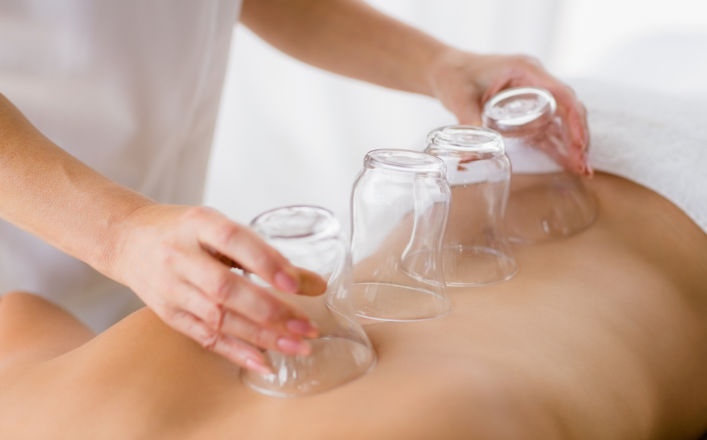 The Benefits of Cupping Therapy